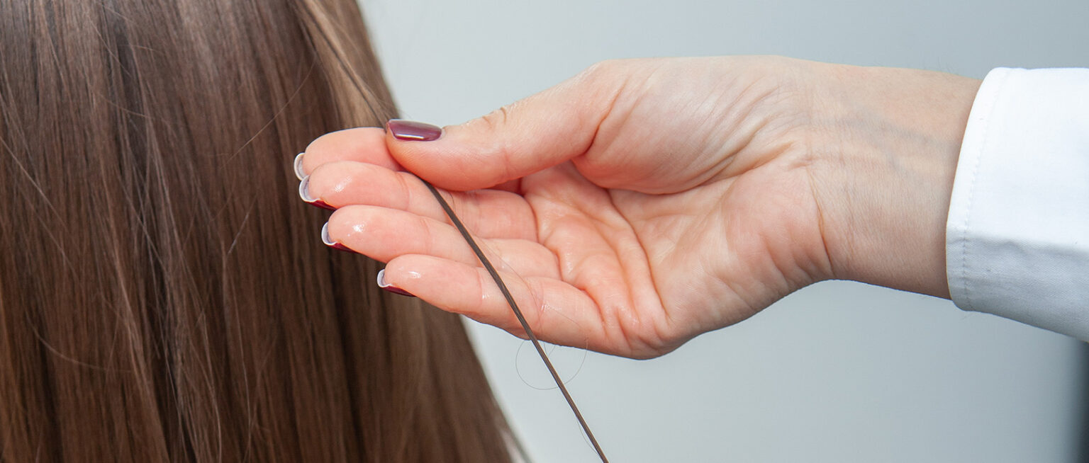 Hair Loss Treatment – GFC Therapy Hair Loss Treatment – GFC Therapy